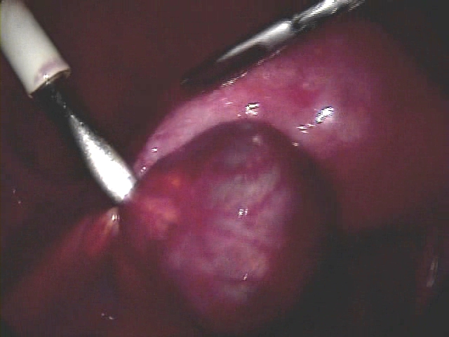 20100506ectopympg_000167806.jpg