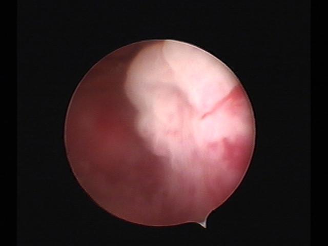 Resectoscopy (2)(16).jpg