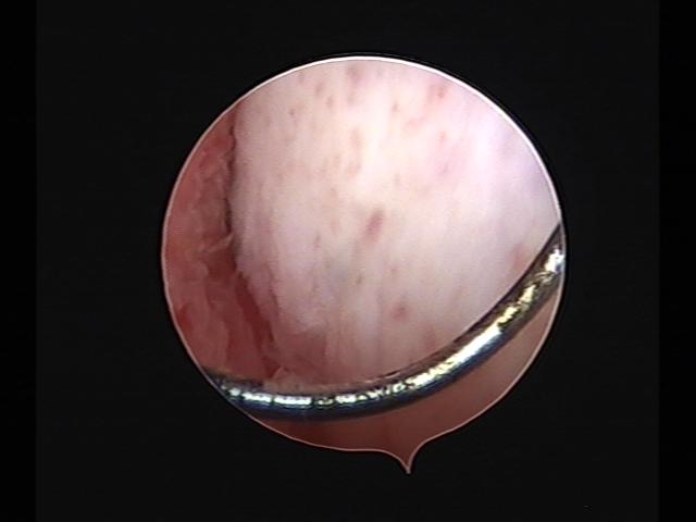 Resectoscopy (2)(26).jpg