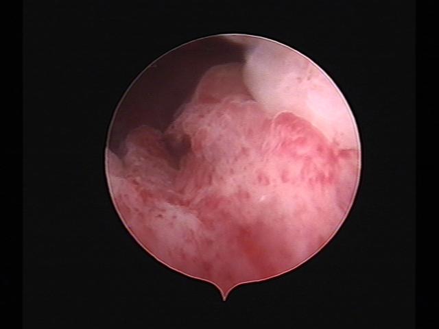 Resectoscopy (2)(28).jpg