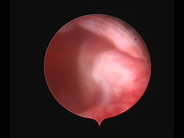 Resectoscopy (2)(29).jpg