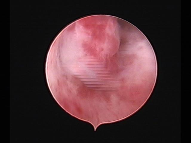 Resectoscopy (2)(30).jpg