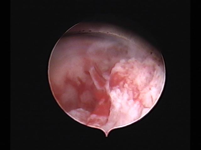 Resectoscopy (2)(31).jpg