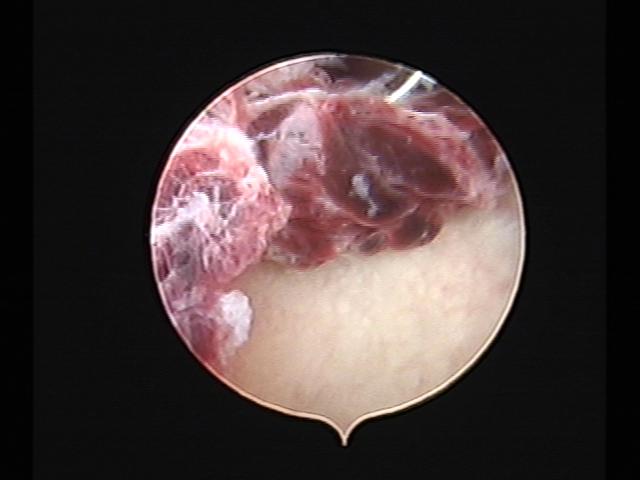 Resectoscopy (2)(32).jpg