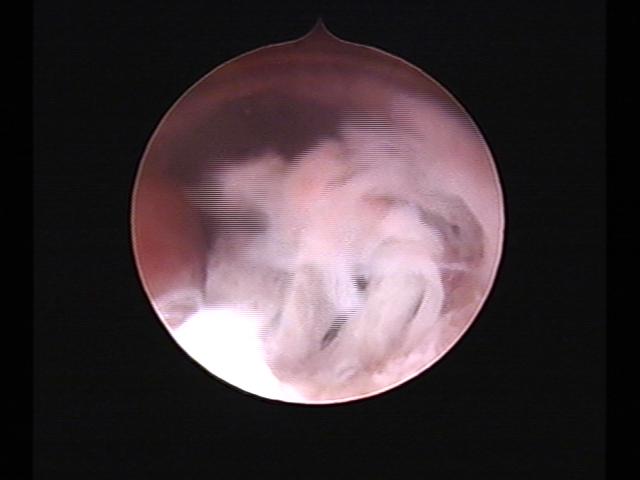 Resectoscopy (2)(37).jpg