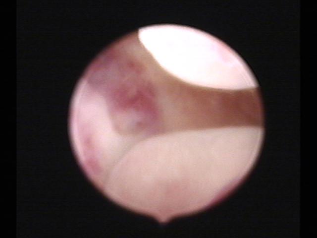 Resectoscopy (2)(39).jpg