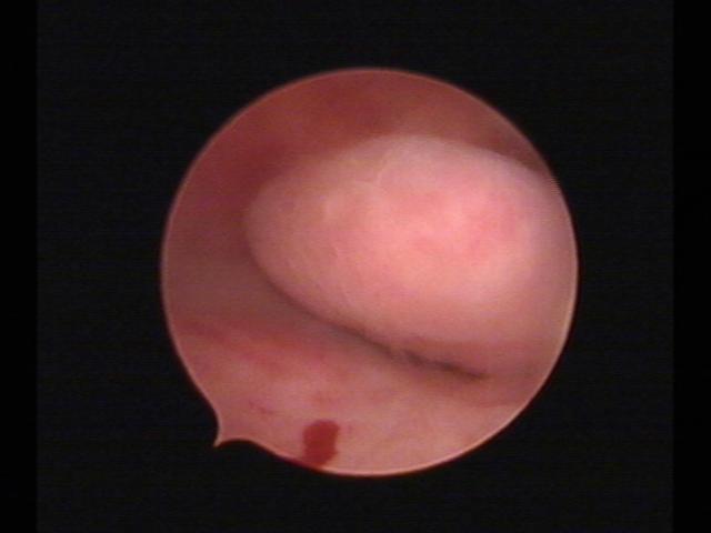 Resectoscopy (2)(41).jpg