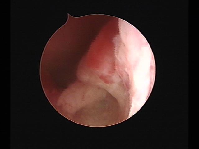 Resectoscopy (2)(48).jpg