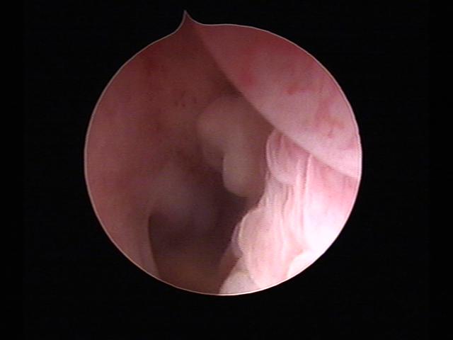 Resectoscopy (2)(50).jpg