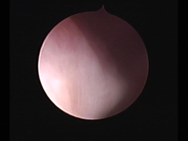 Resectoscopy (2)(51).jpg