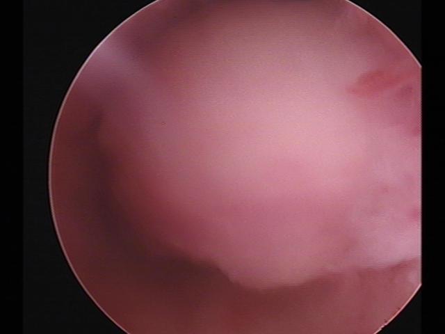 Resectoscopy (3)(15).jpg