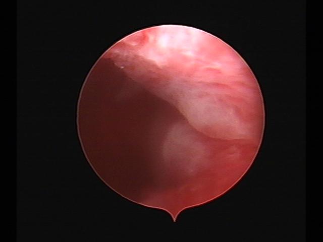 Resectoscopy (3)(26).jpg