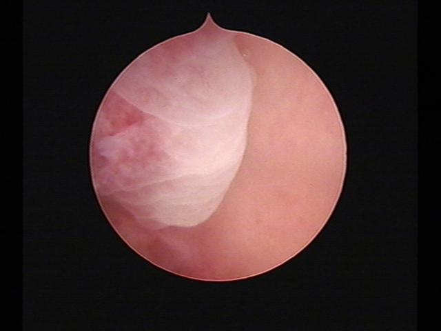 Resectoscopy (3)(30).jpg