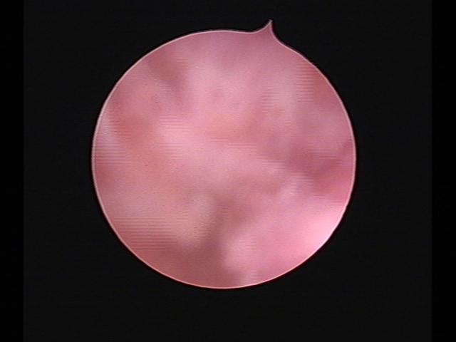 Resectoscopy (3)(35).jpg