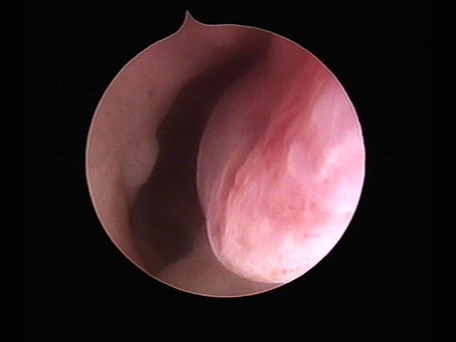 Resectoscopy (3)(36).jpg