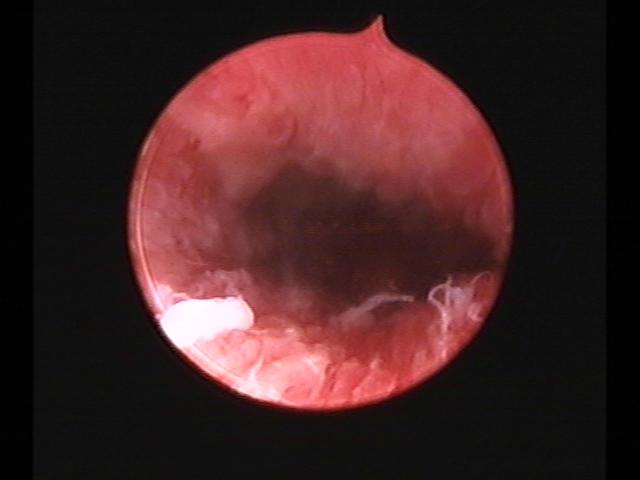 Resectoscopy (4)(23).jpg