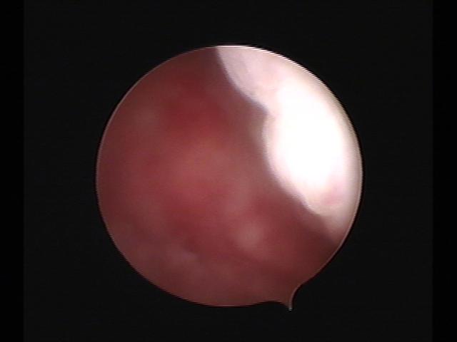 Resectoscopy(14).jpg