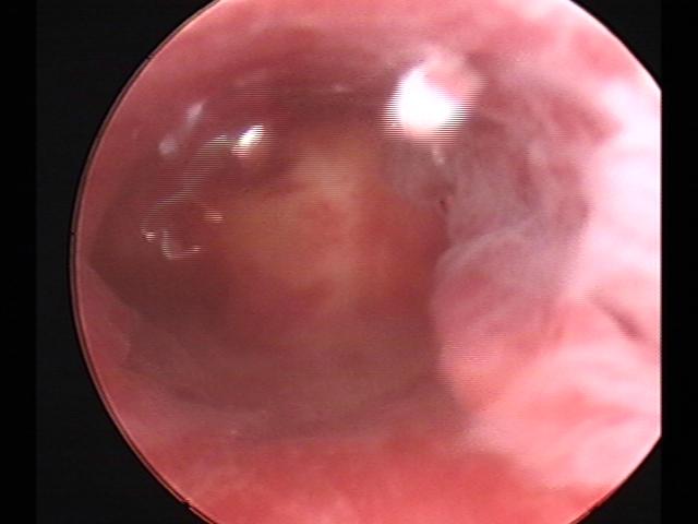 Resectoscopy(22).jpg