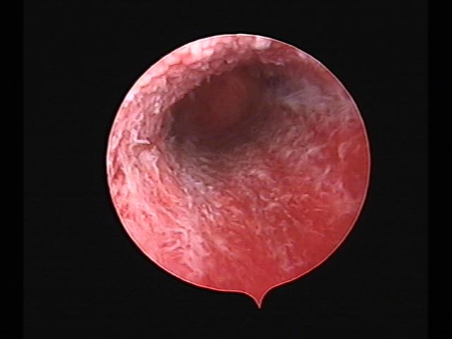 Resectoscopy(23).jpg