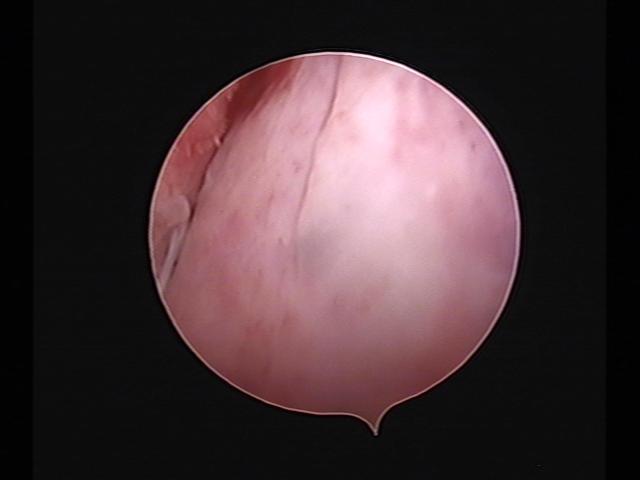 Resectoscopy(24).jpg