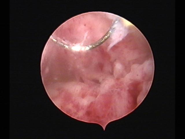 Resectoscopy(25).jpg