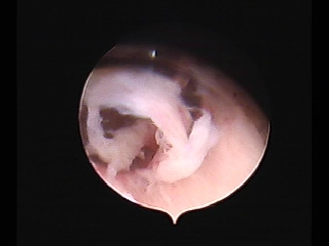 Resectoscopy(28).jpg