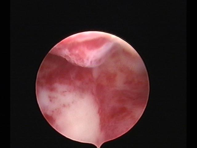 Resectoscopy(29).jpg