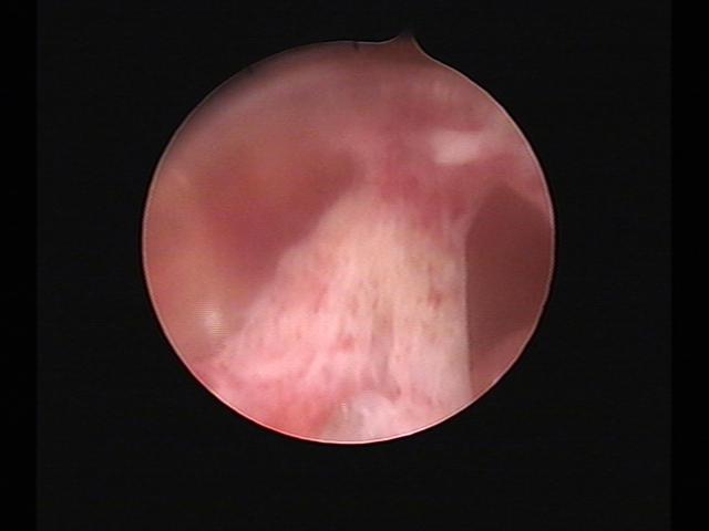 Resectoscopy(30).jpg