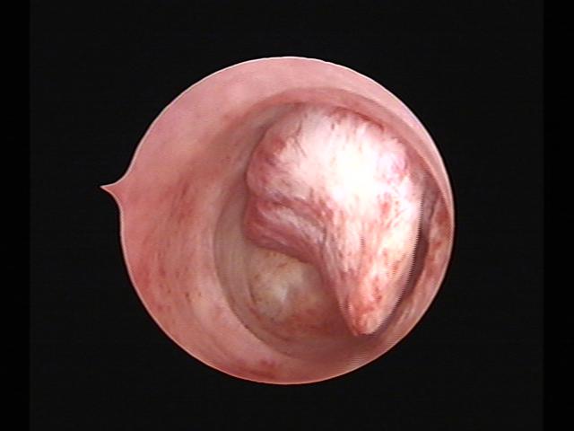 Resectoscopy(36).jpg