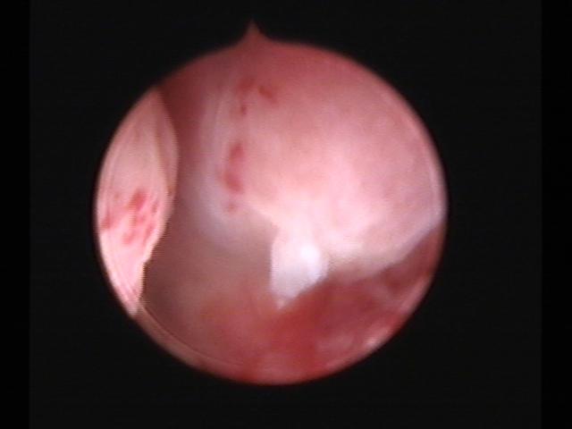 Resectoscopy(37).jpg