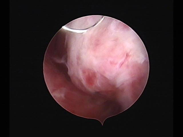 Resectoscopy(39).jpg