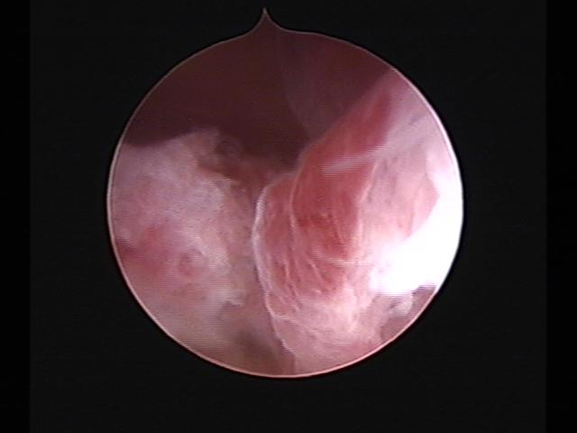 Resectoscopy(41).jpg