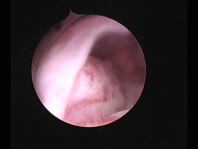 Resectoscopy(43).jpg