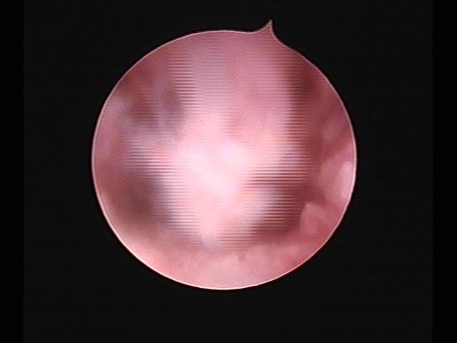 Resectoscopy(44).jpg