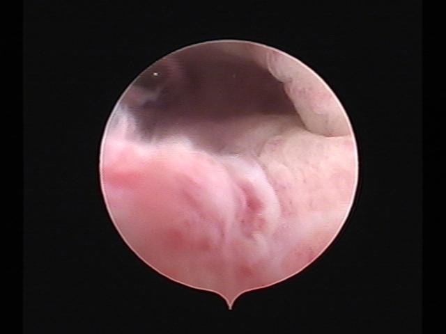 resectoscopy (3)(16).jpg