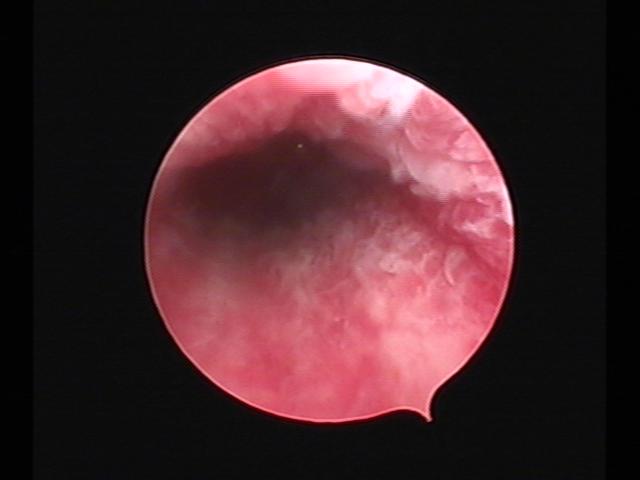 resectoscopy (4)(10).jpg