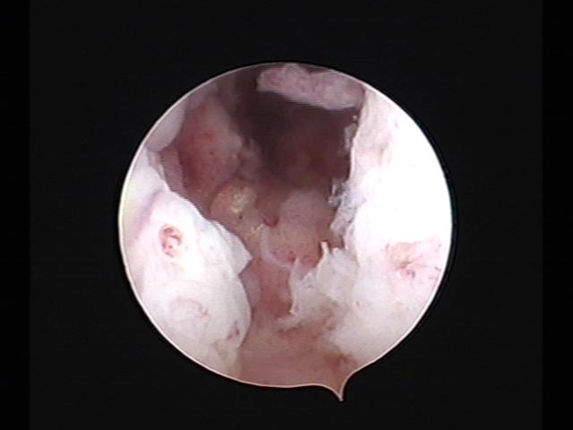 resectoscopy (4)(9).jpg