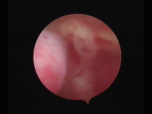 resectoscopy(18).jpg