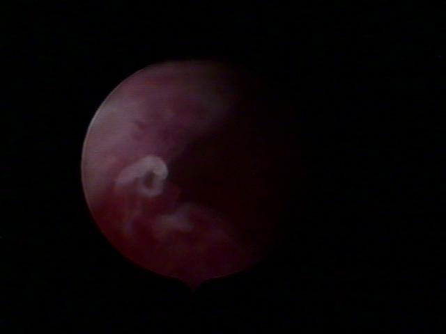 resectoscopy1.jpg